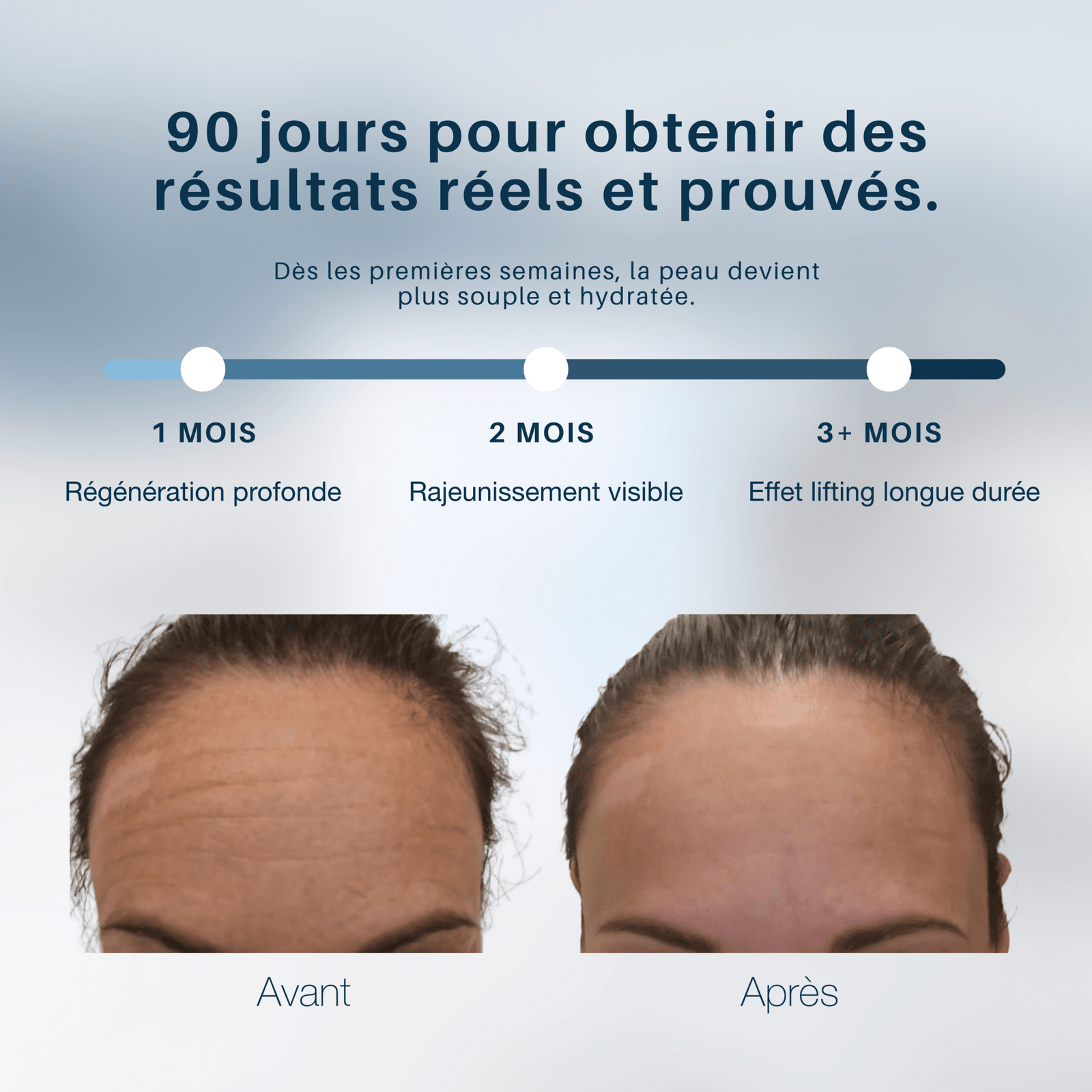 MyCollagenLift - MyPureSkin