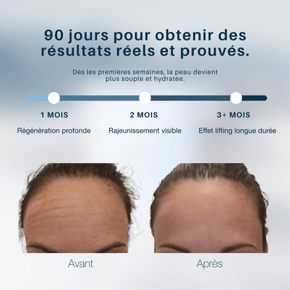 MyCollagenLift - MyPureSkin